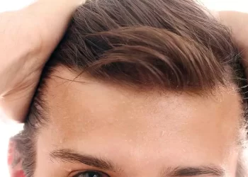 The best hair transplant clinic in Mashhad